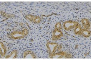 ABIN6277529 at 1/100 staining Human uterus tissue by IHC-P. (GHRH 抗体  (Internal Region))