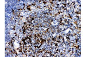Immunohistochemistry (IHC) image for anti-Sequestosome 1 (SQSTM1) (AA 69-96), (N-Term) antibody (ABIN3043937)