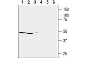 Western blot analysis of rat brain (lanes 1 and 4), mouse brain (lanes 2 and 5) membranes and human brain neuroblastoma (SH-SY5Y) (lanes 3 and 6) cell lysate: - 1-3.