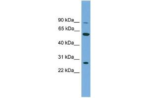 WB Suggested Anti-IMPDH2  Antibody Titration: 0. (IMPDH2 抗体  (N-Term))