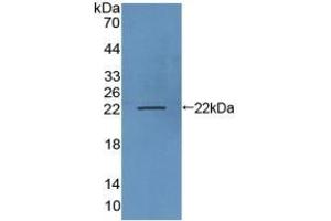 Detection of Recombinant LAMP3, Human using Polyclonal Antibody to Lysosomal Associated Membrane Protein 3 (LAMP3) (LAMP3 抗体  (AA 222-381))