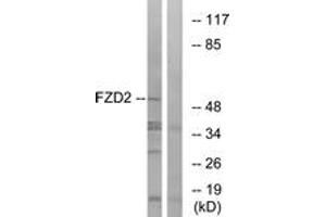 Western blot analysis of extracts from HeLa cells, using FZD2 Antibody. (FZD2 抗体  (AA 201-250))
