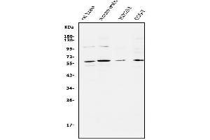 Western blot analysis of APEX2 using anti-APEX2 antibody (ABIN5518737). (APEX2 抗体  (AA 102-210))