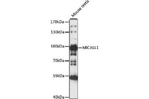 Western blot analysis of extracts of Mouse testis, using MIC antibody (ABIN7268510) at 1:1000 dilution. (MICAL-Like 1 抗体  (AA 614-863))
