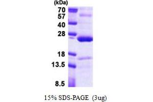 SDS-PAGE (SDS) image for Tumor Necrosis Factor, alpha-Induced Protein 8 (TNFAIP8) (AA 1-198) protein (His tag) (ABIN5853025) (TNFAIP8 Protein (AA 1-198) (His tag))
