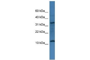 WB Suggested Anti-C14orf177 Antibody Titration: 0. (C14ORF177 抗体  (N-Term))