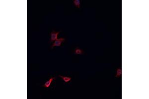 ABIN6268845 staining HeLa cells by IF/ICC. (NRF1 抗体  (Internal Region))