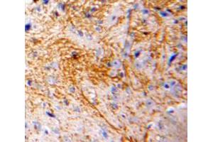Used in DAB staining on fromalin fixed paraffin-embedded Brain tissue (CCL7 抗体  (AA 24-97))
