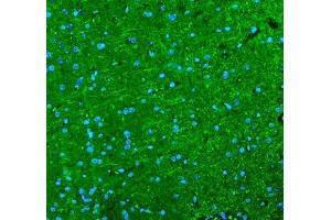 IF analysis of Alpha Internexin using anti-Alpha Internexin antibody (ABIN4886634).