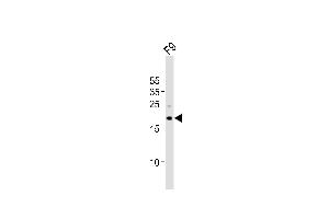 TDGF1 抗体  (N-Term)