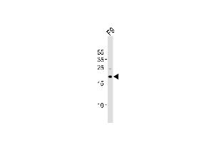 TDGF1 Antikörper  (N-Term)