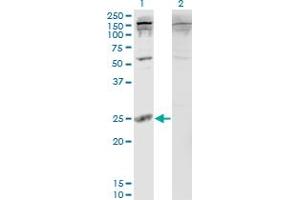Western Blot analysis of PDAP1 expression in transfected 293T cell line by PDAP1 monoclonal antibody (M05), clone 3B10. (PDAP1 抗体  (AA 1-181))
