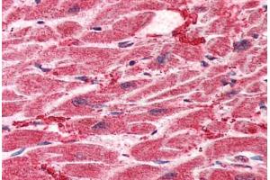 Human Heart (formalin-fixed, paraffin-embedded) stained with HES1 antibody ABIN307170 at 5 ug/ml followed by biotinylated goat anti-rabbit IgG secondary antibody ABIN481713, alkaline phosphatase-streptavidin and chromogen. (HES1 抗体  (AA 24-35))