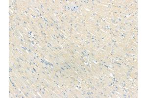 ABIN7094502 and ABIN7098551 at 1/100 staining Rat heart tissue by IHC-P.
