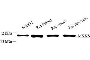 Western blot analysis of MKKS (ABIN7074572),at dilution of 1: 2000 (MKKS 抗体)