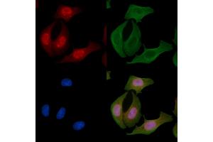 ABIN6256525 and ABIN6267600 staining Hela cells by IF/ICC. (NF-kB p65 抗体  (pThr254))