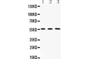 Western blot analysis of FGB expression in rat kidney extract ( Lane 1), mouse liver extract ( Lane 2) and HELA whole cell lysates ( Lane 3). (Fibrinogen beta Chain 抗体  (Middle Region))