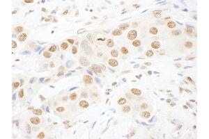 Immunohistochemistry (IHC) image for anti-Topoisomerase I Binding, arginine/serine-Rich, E3 Ubiquitin Protein Ligase (TOPORS) (AA 995-1045) antibody (ABIN7449029)