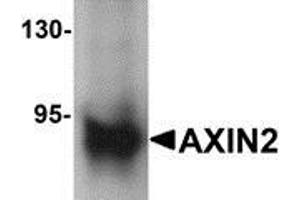 Western blot analysis of AXIN2 in mouse lung lysate with AXIN2 antibody at 1 μg/ml (AXIN2 抗体  (C-Term))