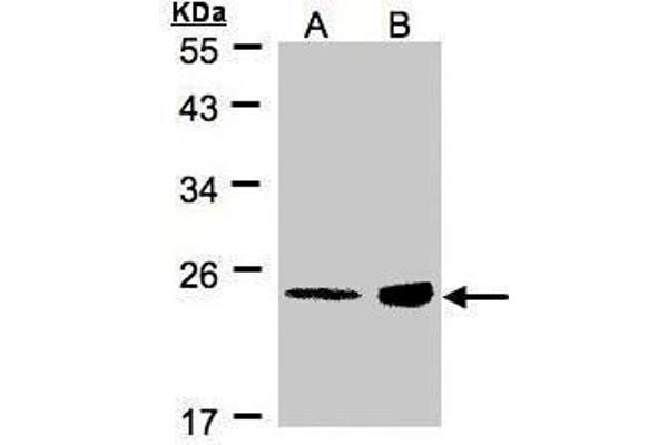 R-Ras Antikörper  (Center)