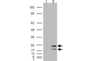 293 overexpressing NRAS and probed with NRAS polyclonal antibody  (mock transfection in first lane), tested by Origene. (GTPase NRas 抗体  (Internal Region))