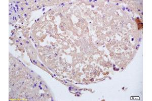 Formalin-fixed and paraffin embedded rat testis labeled with Anti-CCDC11 Polyclonal Antibody, Unconjugated  at 1:200 followed by conjugation to the secondary antibody and DAB staining.