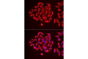 Immunofluorescence (IF) image for anti-Tu Translation Elongation Factor, Mitochondrial (Tufm) (AA 186-455) antibody (ABIN6149701)
