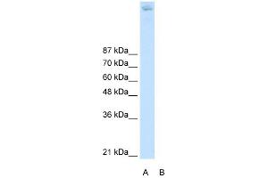 ZBTB38 antibody (20R-1249) used at 0. (ZBTB38 抗体  (N-Term))