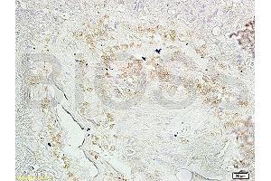 Immunohistochemistry (IHC) image for anti-Tumor Protein P53 (TP53) (N235K), (N239Y) antibody (ABIN729763)