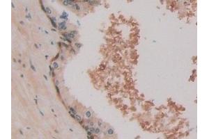 Immunohistochemistry (IHC) image for anti-Heat Shock 70kDa Protein 1A (HSPA1A) (AA 285-641) antibody (ABIN7443083)