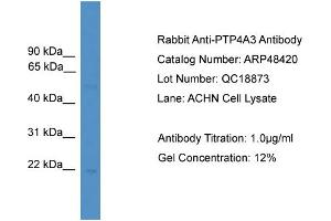 Western Blotting (WB) image for anti-Protein Tyrosine Phosphatase Type IVA, Member 3 (PTP4A3) (C-Term) antibody (ABIN2773919)