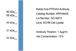 WB Suggested Anti-PTP4A3  Antibody Titration: 0. (PTP4A3 抗体  (C-Term))