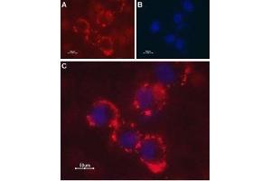 Expression of Latrophilin-1 receptor in SH-SY5Y cell line - Cell surface detection of Latrophilin-1 receptor in intact living human neuroblastoma (SH-SY5Y) cells. (Latrophilin 1 抗体  (Extracellular, N-Term))