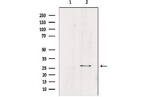 Western blot analysis of extracts from HepG2, using FGF23 Antibody. (FGF23 抗体  (Internal Region))