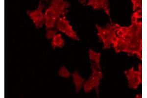 ABIN6272530 staining HuvEc by IF/ICC. (UL97 抗体)