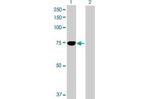 Western Blotting (WB) image for anti-Transforming Growth Factor, beta-Induced, 68kDa (TGFBI) (AA 1-683) antibody (ABIN520880)