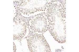 Immunohistochemistry analysis of paraffin-embedded rat testis using,AF10 (ABIN7075234) at dilution of 1: 1200 (MLLT10 抗体)