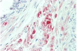Human Prostate: Formalin-Fixed, Paraffin-Embedded (FFPE) (PTPLA 抗体  (AA 37-66))