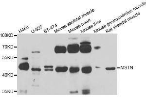 Western blot analysis of extracts of various cell lines, using MSTN antibody.