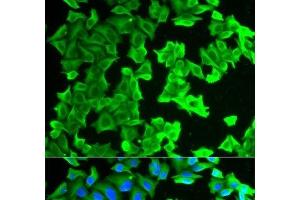 Immunofluorescence analysis of HeLa cells using RPLP0 Polyclonal Antibody (RPLP0 抗体)