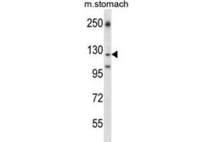 Western Blotting (WB) image for anti-Laminin, gamma 2 (LAMC2) antibody (ABIN2997656) (LAMC2 抗体)