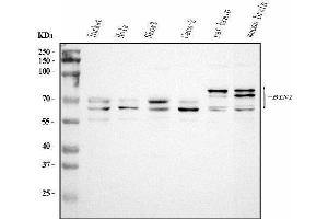 Western blot analysis of BIN1 using anti-BIN1 antibody (ABIN7601780).