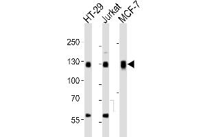 Western blot analysis of lysates from HT-29, Jurkat, MCF-7 cell line (from left to right), using SMG7 Antibody (C-term) (ABIN6244188 and ABIN6577686). (SMG7 抗体  (C-Term))