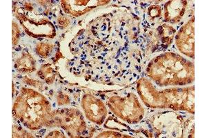 Immunohistochemistry of paraffin-embedded human kidney tissue using ABIN7143447 at dilution of 1:100 (ARF4 抗体  (AA 1-180))