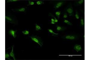 Immunofluorescence of purified MaxPab antibody to PCNA on HeLa cell.