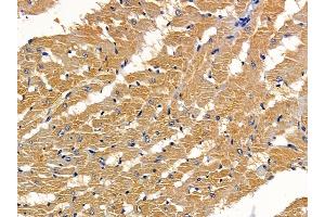 ABIN6261215 and ABIN6277963 at 1/100 staining rat heart tissue by IHC-P. (DAB2 抗体  (C-Term))
