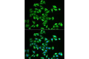 Immunofluorescence analysis of A549 cell using POMGNT2 antibody. (C3orf39 抗体)