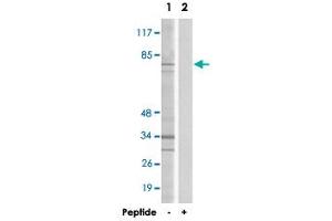 Western blot analysis of extracts from HepG2 cells, using DDX51 polyclonal antibody . (DDX51 抗体  (C-Term))