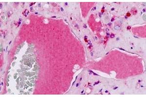 Immunohistochemistry (IHC) image for anti-Coagulation Factor II (thrombin) Receptor-Like 2 (F2RL2) (AA 278-327), (Cleaved-Arg327) antibody (ABIN2879290)