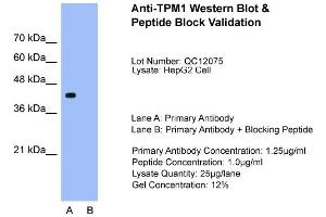 Host:  Rabbit  Target Name:  TPM1  Sample Type:  HepG2  Lane A:  Primary Antibody  Lane B:  Primary Antibody + Blocking Peptide  Primary Antibody Concentration:  1. (Tropomyosin 抗体  (N-Term))